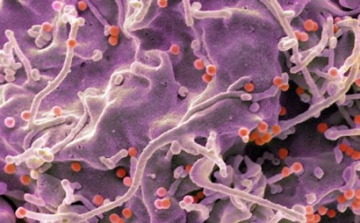 Vắc-xin HIV công nghệ mRNA kích hoạt phản ứng miễn dịch mạnh ở người